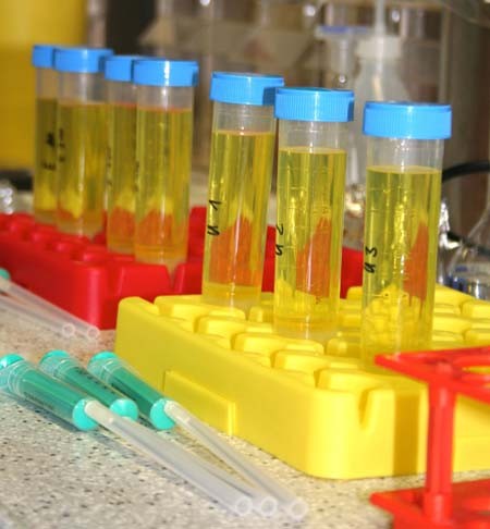 Sechs Reagenzgläser mit gelber Flüssigkeit stehen in einem roten und gelben Halter. Daneben liegen einige Pipetten. Die Gläser sind mit blauen Kappen verschlossen und beschriftet. Die Umgebung wirkt labortechnisch und organisiert.